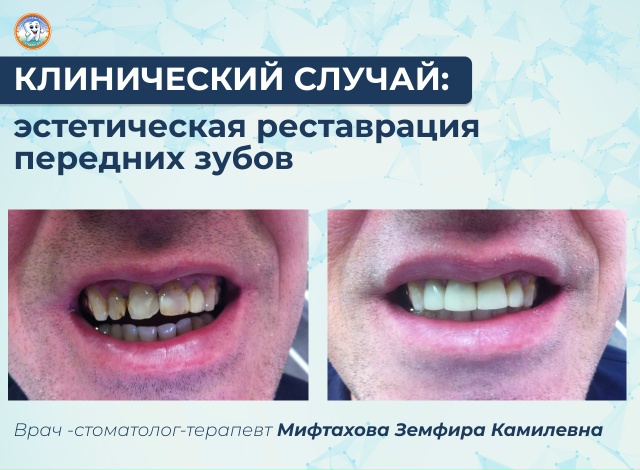 Клинический случай